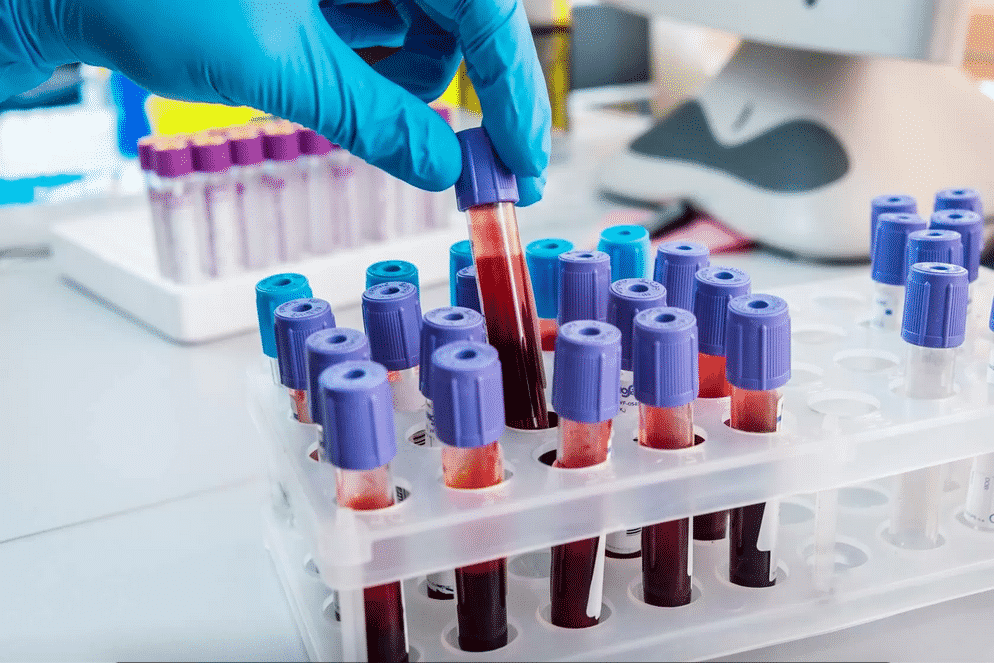 blood sample in vials